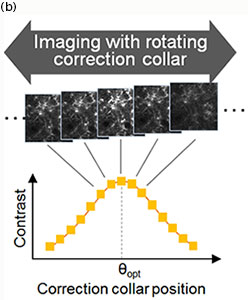 TruResolution Correction Collar Position