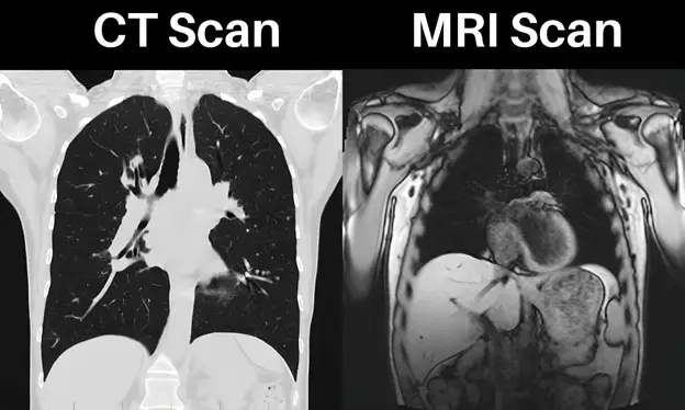 تفاوت تصاویر تهیه شده از تکنیک CT اسکن و MRI