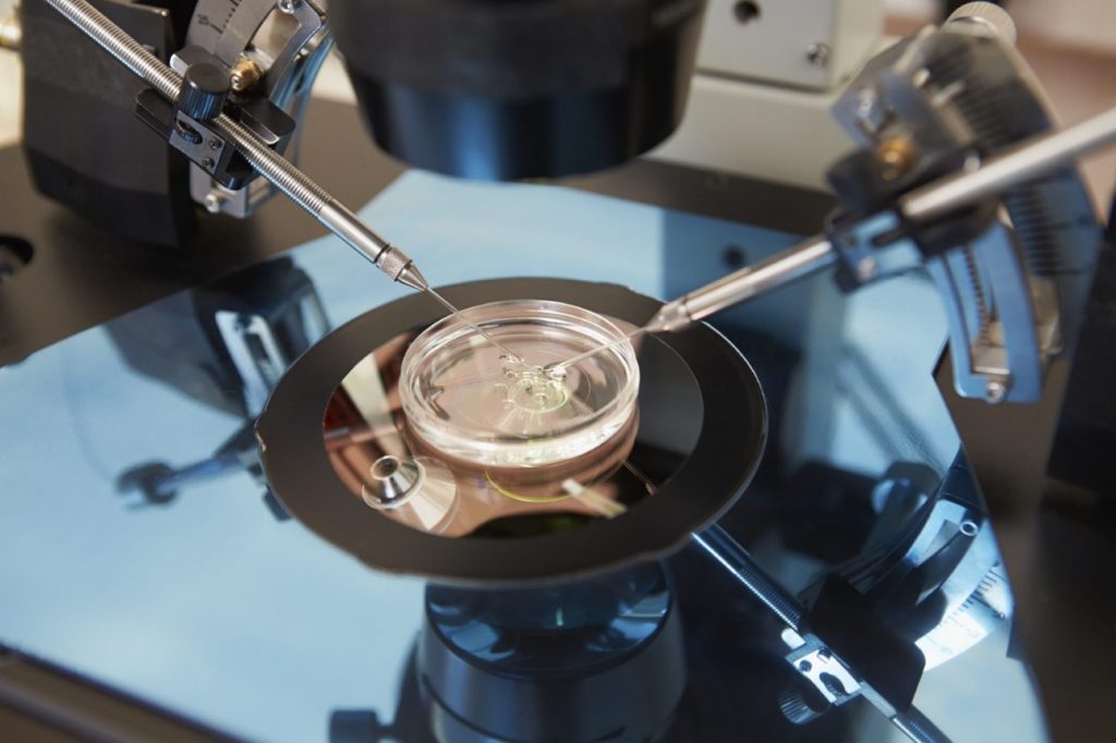 انجام لقاح تخمک و اسپرم درون پتری دیش در IVF