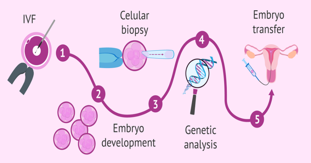 PGT در روند IVF