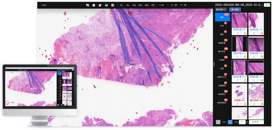 Pathology AI