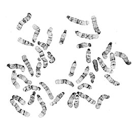 G-banding
