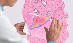 هوش مصنوعی در پاتولوژی دیجیتال