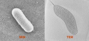 مقایسه میکروسکوپ الکترونی TEM و SEM