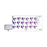 سیستم تشخیص Gastric Cancer Al کمپانی Kfbio