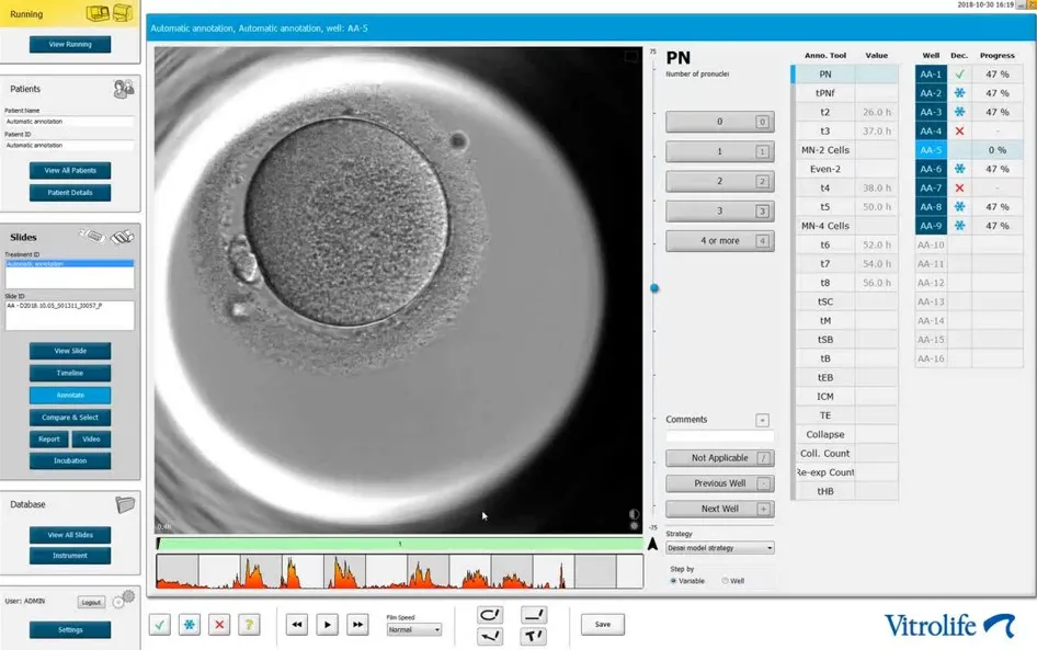 انکوباتور تایم لپس و هوش مصنوعی
