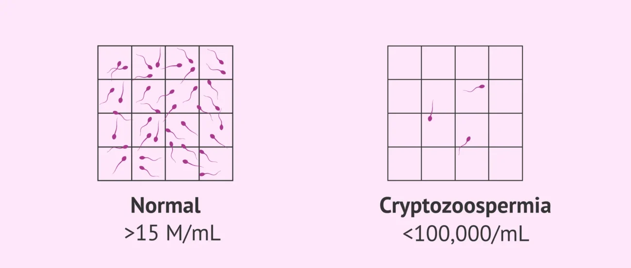 کریپتوزواسپرمیا