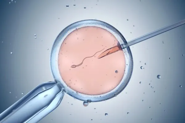 روش های آماده سازی اسپرم برای IVF