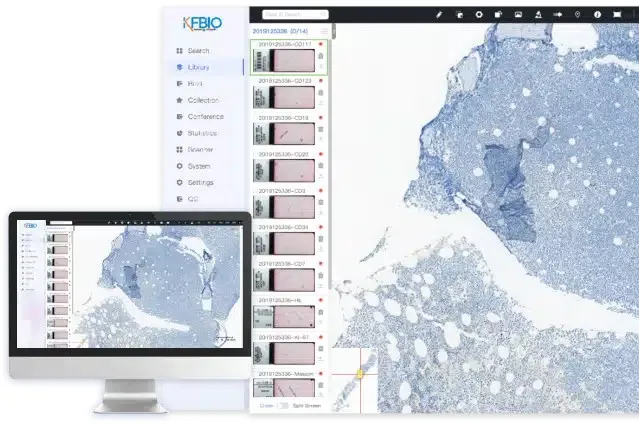 WSI